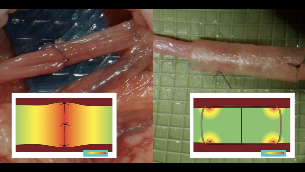 Two images, one showing localized tension at the coaptation site of a direct nerve repair and one showing tension concentrated away from the coaptation site of a connector assisted nerve repair